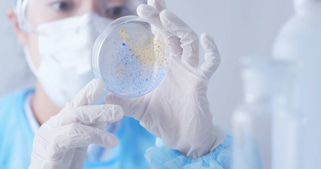 Scientist checking Petri dish